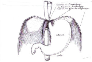 estomac-et-diaphragme