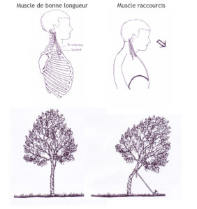 Effets des raccourcissements musculaires sur la colonne vertébrale-Ce dessin provient du volume « Libérer le cœur » écrit par Yvette Clouet.