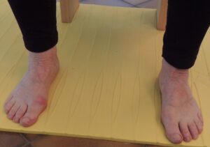 Corriger l'hallux valgus-Début Hallux Valgus- Déviation et rougeur-Cours et Stages-Yoga-Yvette Clouet-13005 Marseille