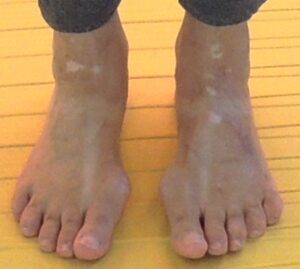 L'Hallux valgus commence au pied plus plat-Cours et Stages-Yoga-Yvette Clouet-13005 Marseille