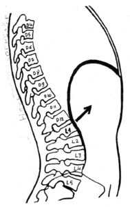 Traction du diaphragme sur la vertèbre L1 : le diaphragme tendu augmente la cambrure - Yoga-Marseille 5è-Yvette Clouet